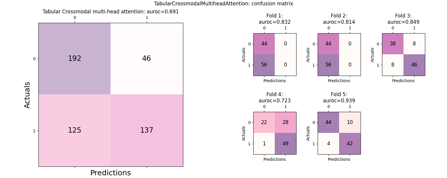 TabularCrossmodalMultiheadAttention: confusion matrix, Tabular Crossmodal multi-head attention: auroc=0.691, Fold 1: auroc=0.832, Fold 2: auroc=0.814, Fold 3: auroc=0.849, Fold 4: auroc=0.723, Fold 5: auroc=0.939
